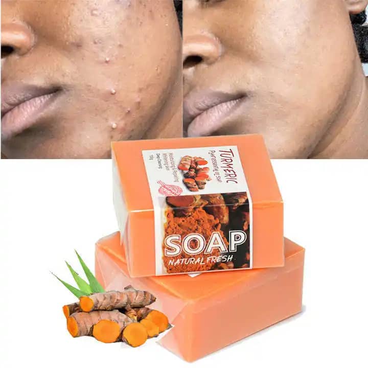 Savon éclaircissant anti taches et bouton