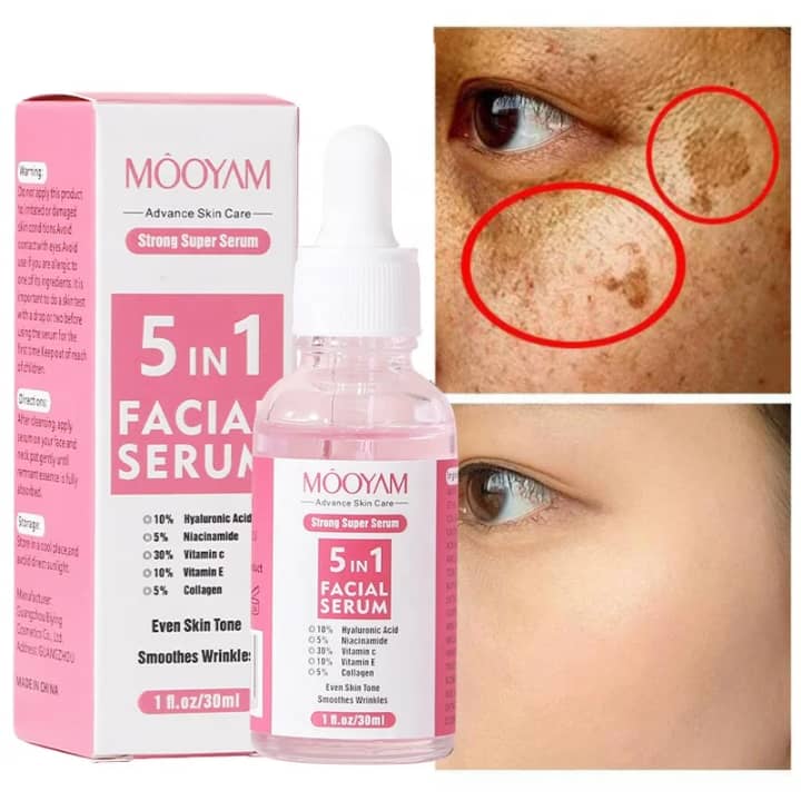 Serum5 in 1 éclaircissante pour le rousseur et tache sombre