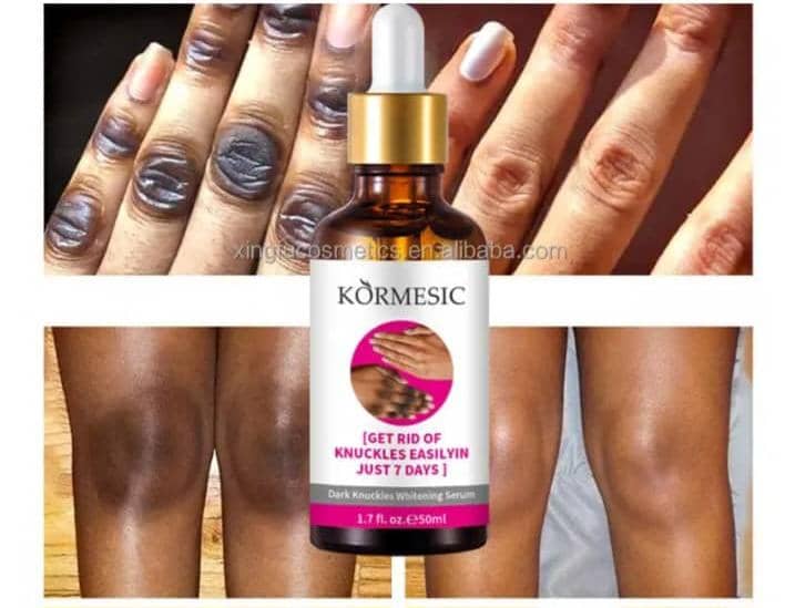 Serum correcteur de tache sombre pied genoux