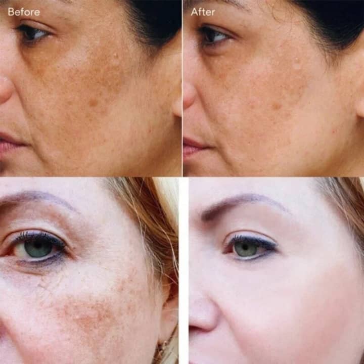 "Texture serum anti-taches anti-acné"