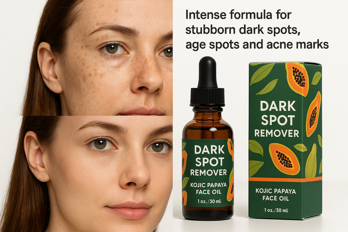 Huile anti-taches papaye