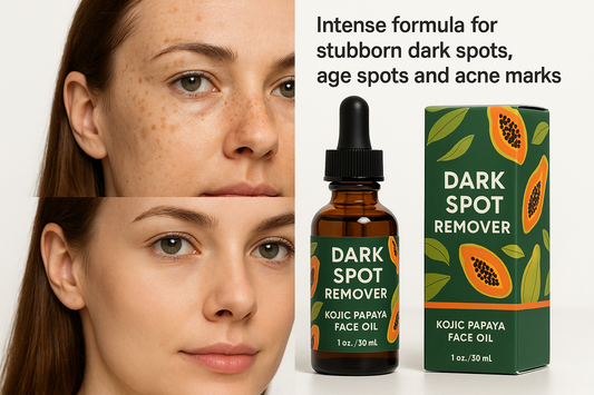 Huile anti-taches papaye