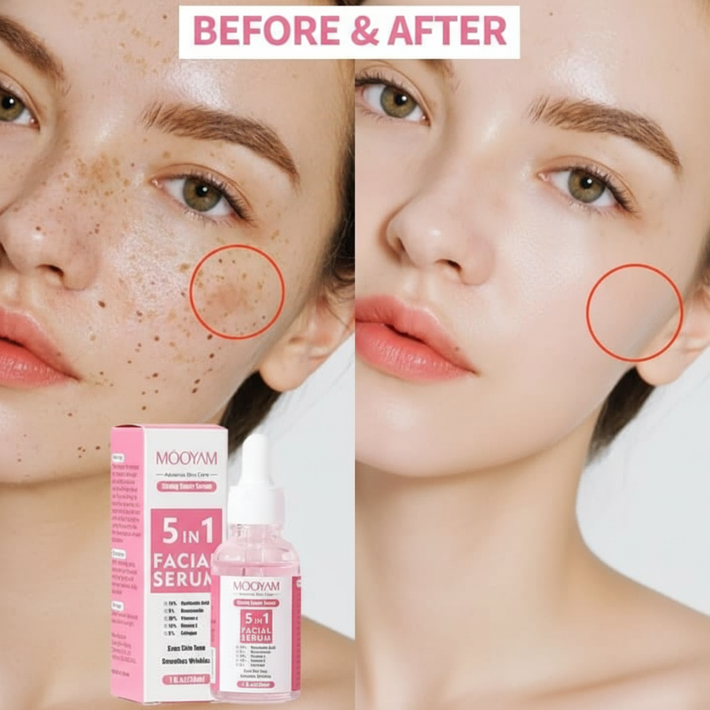 Résultats avant après