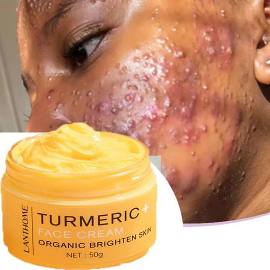 "Crème correcteur boutons et cicatrices Palo Cosmétique"