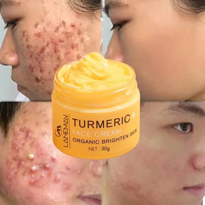 "Texture crème correcteur boutons"