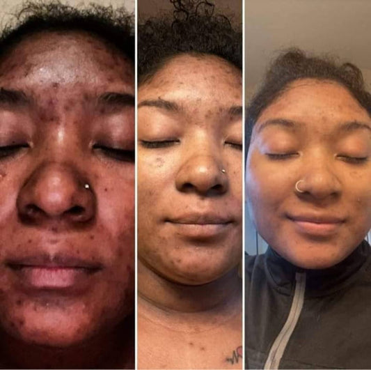 Creme correcteur de tache