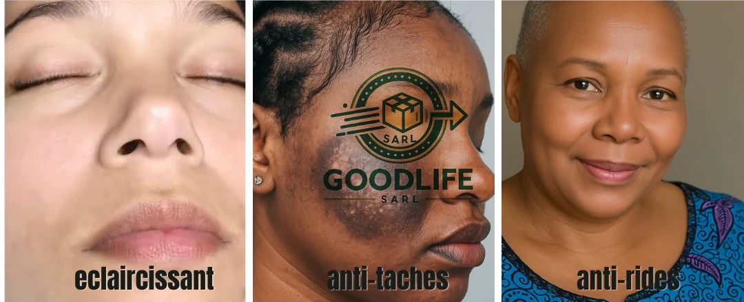 Crème réparatrice de tache de rousseur ,et sombre