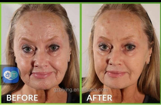 "Résultats crème éclaircissante Palo Cosmétique"